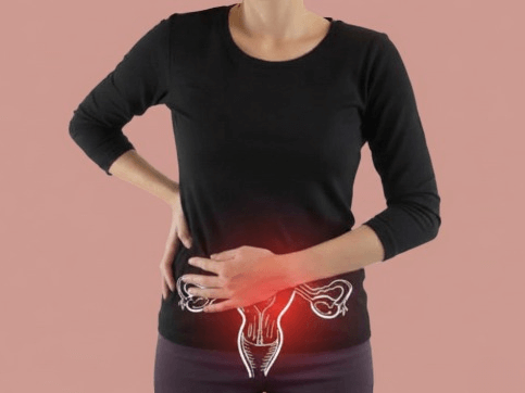 Kyste ovarien : quelles sont les causes et comment le traiter ?